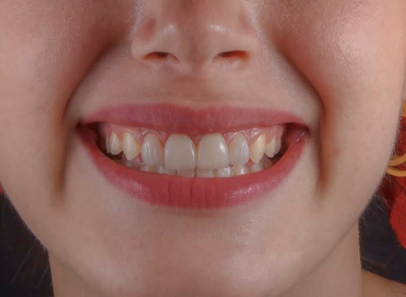 Periodontics (Gum Care)