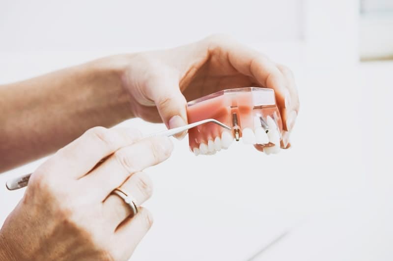 Advance Dental Implants