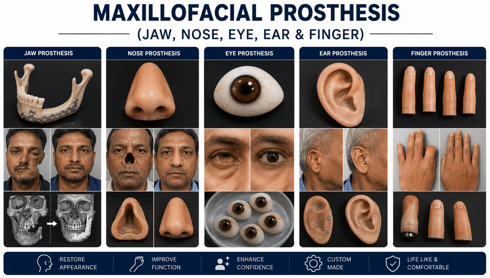 Maxillofacial Prosthesis (Jaw, Nose, Eye, Ear & Finger)